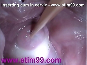 Stick with regard to semen cum with regard to cervix nearly dilatation pussy send back